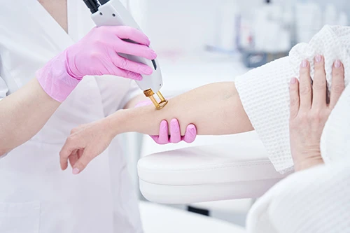 Laser Hair Removal